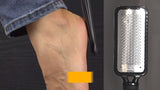 Colossal foot rasp callus remover